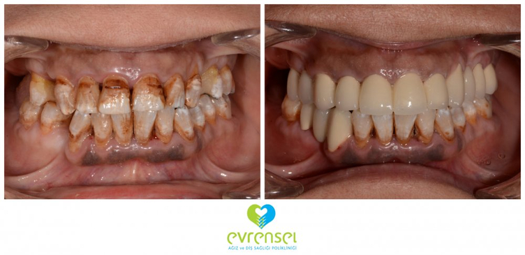 Slider image (10) Evrensel Dental Clinic in Ankara Turkey